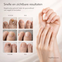 NailRestore – Herstel je nagels zichtbaar van binnenuit